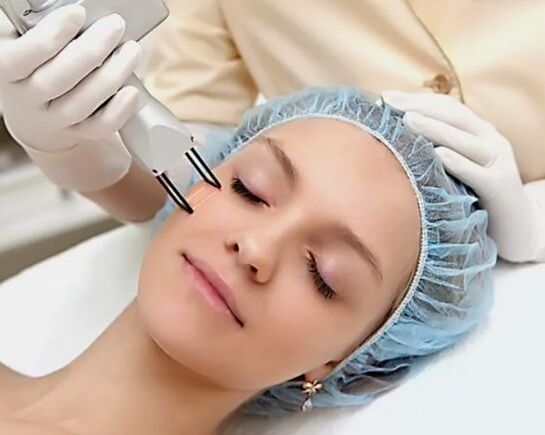 Field laser renewal