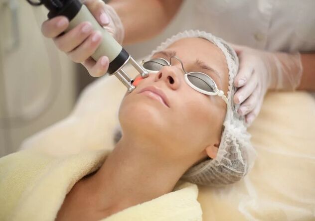 Renewal of the skin in the face