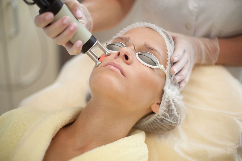 Laser the renewal of the skin