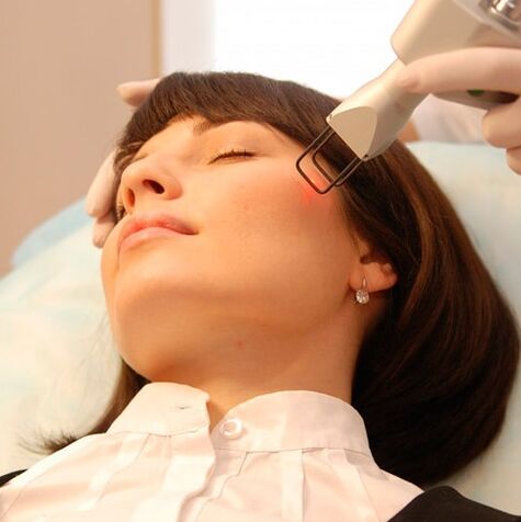 Field laser renewal
