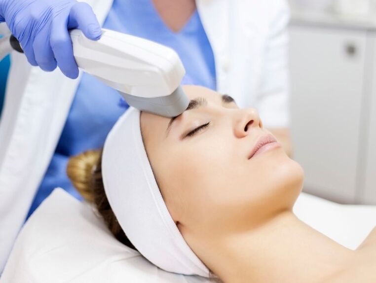 Laser the renewal of the skin
