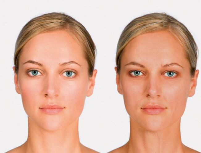 Face after and for renewal
