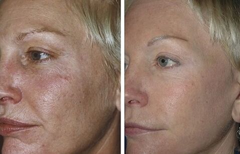 non-destructive restoration before and after photos