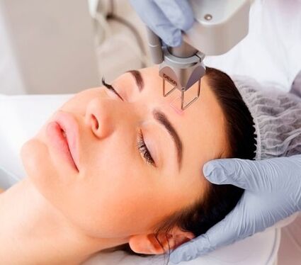 the core of the fractional laser procedure to rejuvenate facial skin