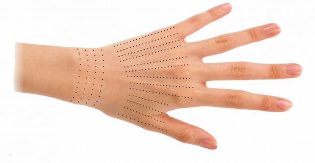 Injection sites for hands during organic